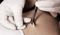 Body Piercing